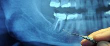 A fogak és a szervek kapcsolata
